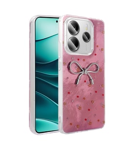 Xiaomi Redmi Note 14 5G Uyumlu Kılıf Kamera Korumalı Figürlü Zore Ponti Silikon Kapak