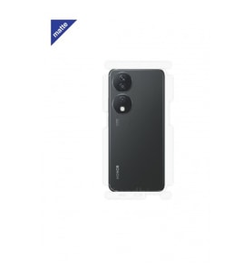 Honor X7b Mat Arka ve Yan Koruyucu Poliüretan Film