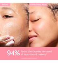Lexroo Vinohydra Cleansing Gel 150 ml
