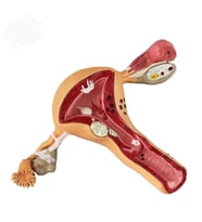 Uterus Pelvik Taban Maketi Model 41