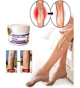 V.ricose And Spider Vns Sthing Leg Cream 100 ml