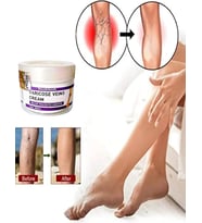 V.ricose And Spider Vns Sthing Leg Cream 100 ml