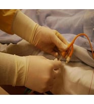 Rüsch Foley Sonda Kauc¸uk 2 Yollu No: 14 Yeşil 1 adet