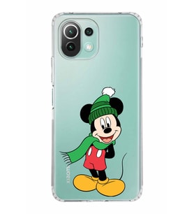 Xiaomi  Mi 11 Lite  Kamera Korumalı Kapak Mickey Mouse Tasarımlı Şeffaf  Kılıf