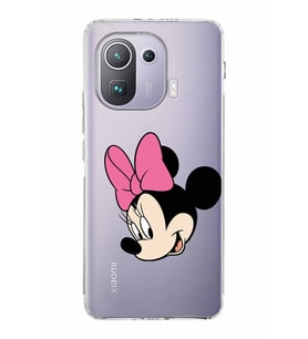 Xiaomi  Mi 11 Pro  Kamera Korumalı Kapak Minnie Mouse Tasarımlı Şeffaf  Kılıf