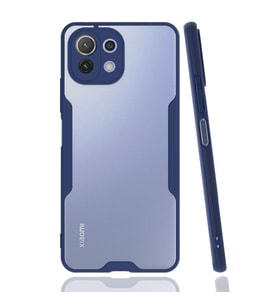 Mi̇ 11 Lite Platin - Lacivert