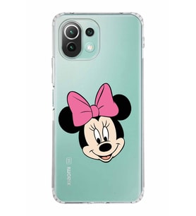 Xiaomi  Mi 11 Lite  Kamera Korumalı Kapak Minnie Mouse Tasarımlı Şeffaf  Kılıf