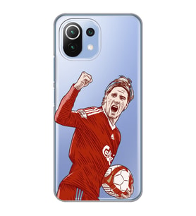 Xiaomi Mi 11 Lite Uyumlu Fernando Torres Desenli Şeffaf Telefon Kılıfı
