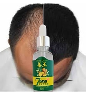 7Days 30ML Gingergerminalessentialoil Hair Growth Loss Treatment Serum Unisex Saç Bakım Yağı
