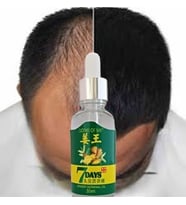 7Days 30ML Gingergerminalessentialoil Hair Growth Loss Treatment Serum Unisex Saç Bakım Yağı