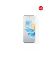 Honor 100 Ekran Koruyucu Tpu Film