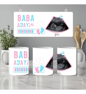 Baba Adayı Ultrason Fotoğraflı Kupa Bardak, Baba Adaylarına Hediye, Pembe Mavi ve İki Renk Seçenekli
