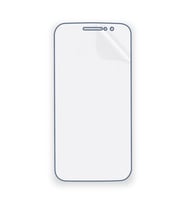 SChitec MOTOROLA Moto M (XT1663) Uyumlu Ön Yüzey Nano Şeffaf Hidrojel Ekran Koruyucu