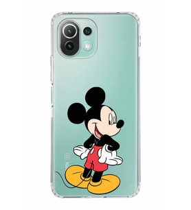 Xiaomi  Mi 11 Lite  Kamera Korumalı Kapak Mickey Mouse Tasarımlı Şeffaf  Kılıf