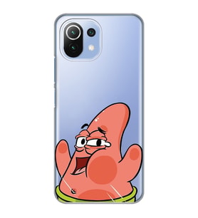 Xiaomi Mi 11 Lite Uyumlu Patrick Star Desenli Şeffaf Telefon Kılıfı