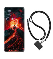 Xiaomi Mi 13 Lite Kılıf Silikon Boyun Askılı İpli Desenli Silikon Yanardağ 1611