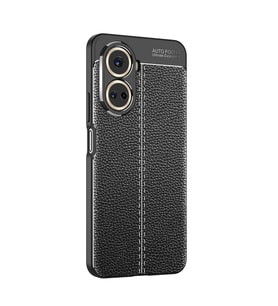 Vendas Huawei Nova 10 SE Uyumlu Deri Desenli Niss Dikiş Tasarımlı Darbe Dirençli Silikon Kılıf (Siyah)
