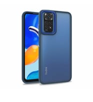 Xiaomi Redmi Note 11 Global Kılıf Case, Kamera Lens Korumalı Elektroplatin Kaplama Sert PC Koruyucu Colourful Platinum Serisi (Mavi)