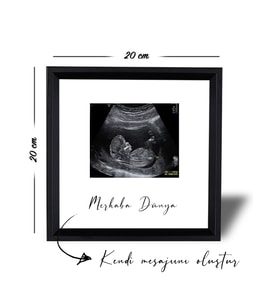 Özel Bebek Fotoğraflı ve Özel Notlu Anı Çerçevesi 20x20cm (Siyah)