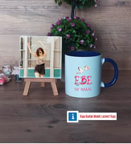 Ebeye Hediye Fotoğraflı Dekoratif Taş, Kupa Bardak Beyaz Hediye Tıp Bayramı Ebeler Günü Hediyesi (Model 3)