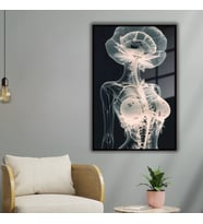 Metal Çerçeveli Cam Poliklinik Tablosu Sanatsal Radyolojik İnsan (Siyah)
