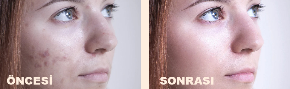 prapazar.com pazaryeri ciceksepeti entegrasyonu